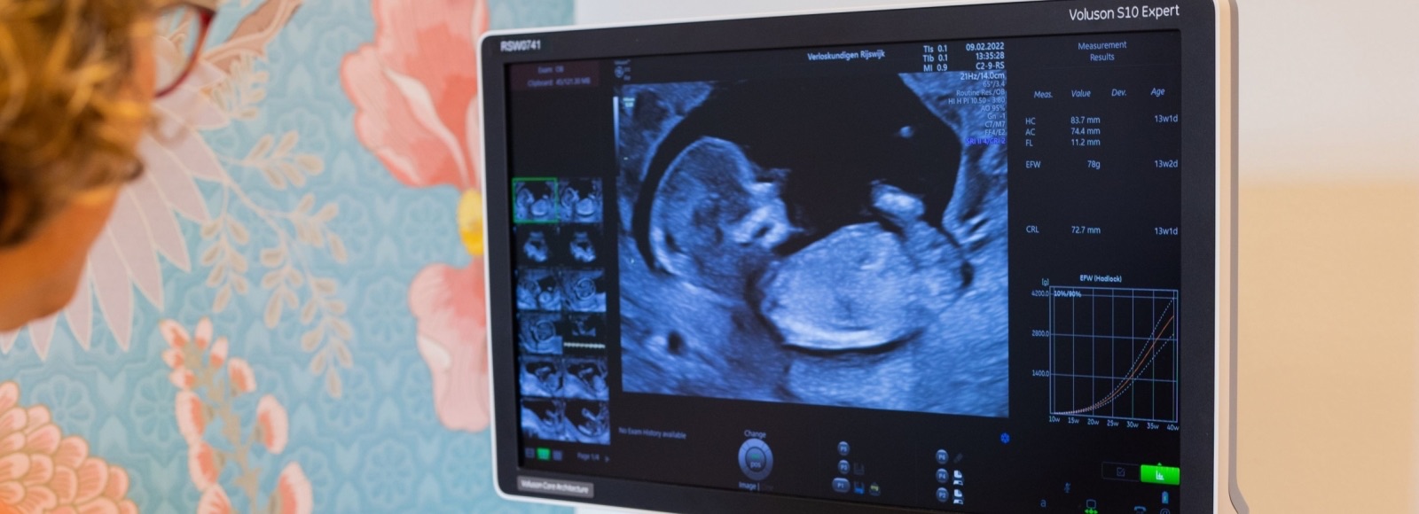 Echoscopist bekijkt een zwangerschapsecho op het scherm